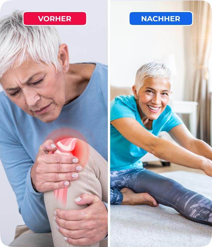 Vorher-Nachher-Kampagnenmotiv des Herstellers zum Wellnee Kniepflaster (Symbolbild)